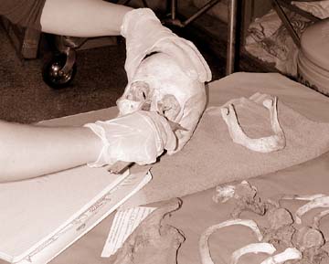 human skull, jawbone and miscellaneous bones being examined by student wearing surgical gloves